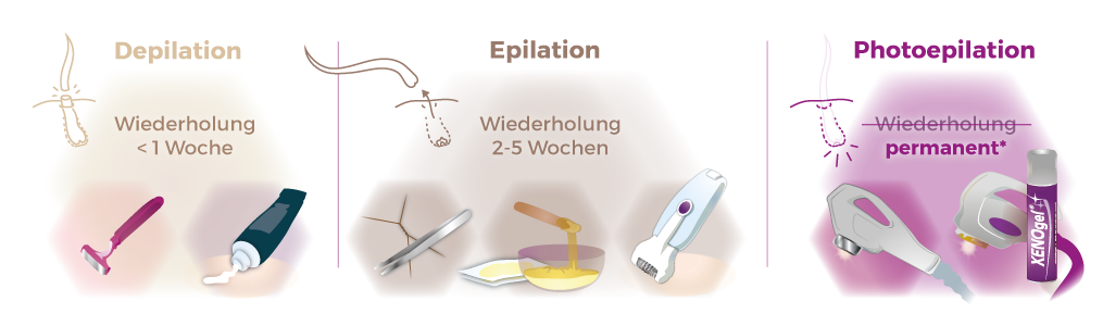 Illustration Behandlungsoptionen